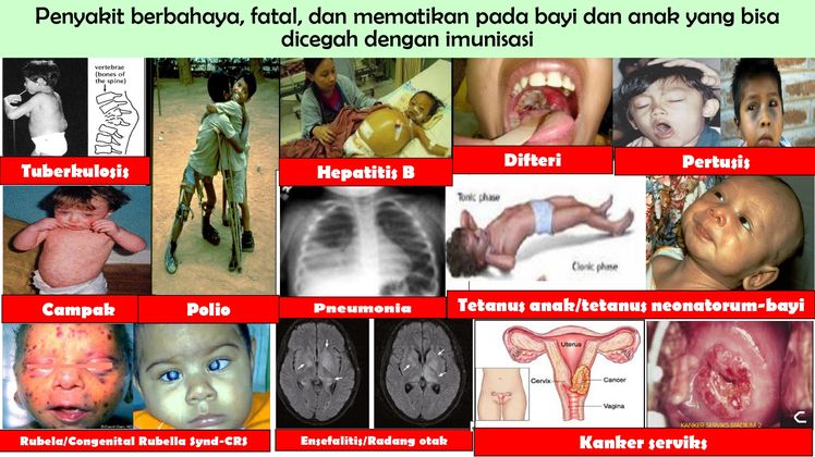 penyakit berbahaya pd3i penyakit berbahaya pd3i