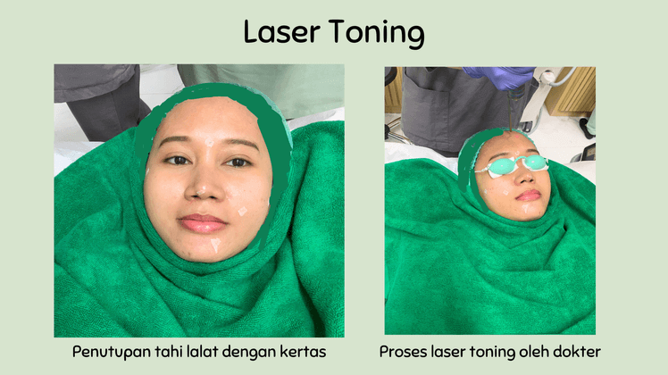photo facial glow zap