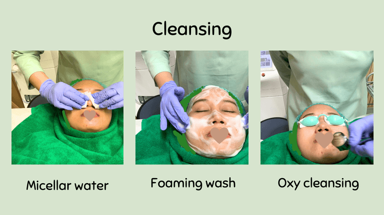 photo facial glow zap