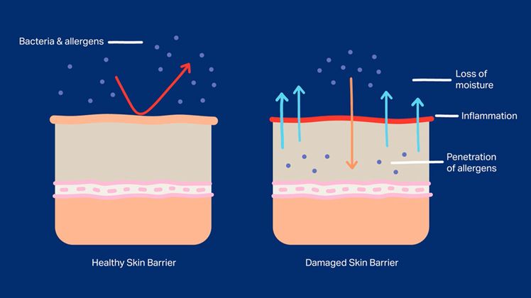 apa itu skin barrier