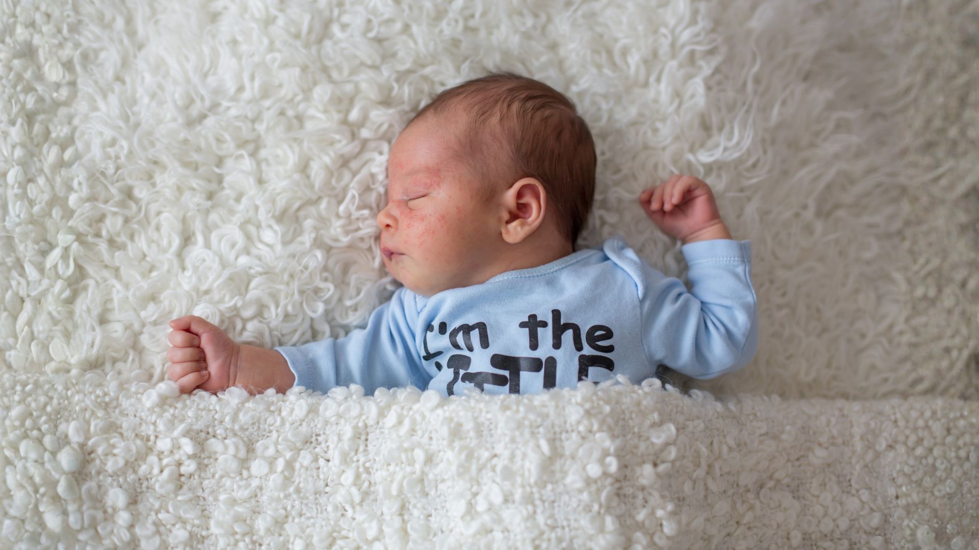 jenis ruam yang sering ditemukan pada bayi